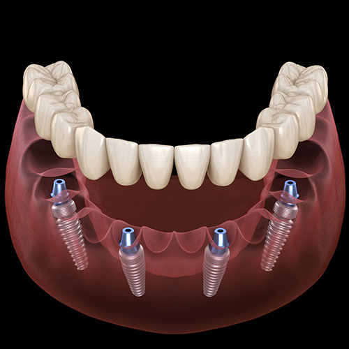 stony-plain-dental-family-dentist Stony Plain Dental