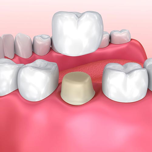 stony-plain-dental-family-dentist Stony Plain Dental