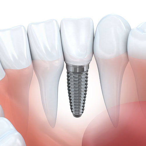 stony-plain-dental-family-dentist Stony Plain Dental