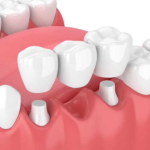 stony-plain-dental-family-dentist Stony Plain Dental